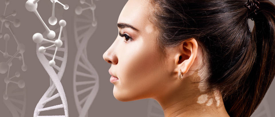 Ostali dermatološki problemi